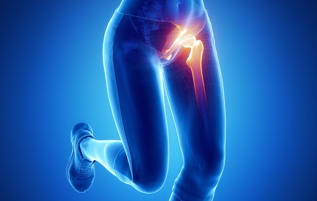 Hip Pain Articles