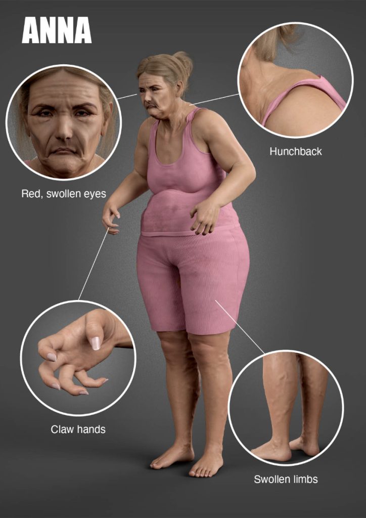 The physical impact of working from home could be very detrimental with poor posture being a fallout