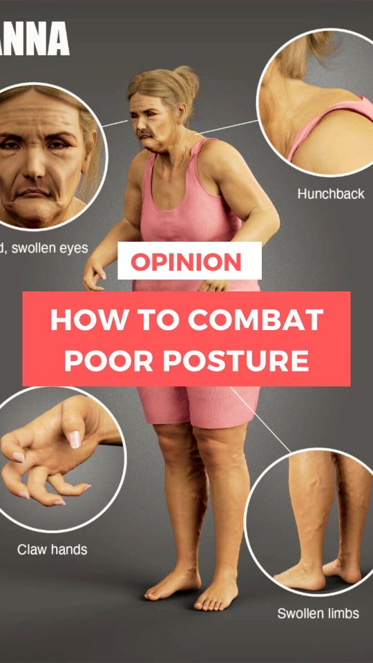 Working from Home can lead to Poor Posture How do You Combat it? My